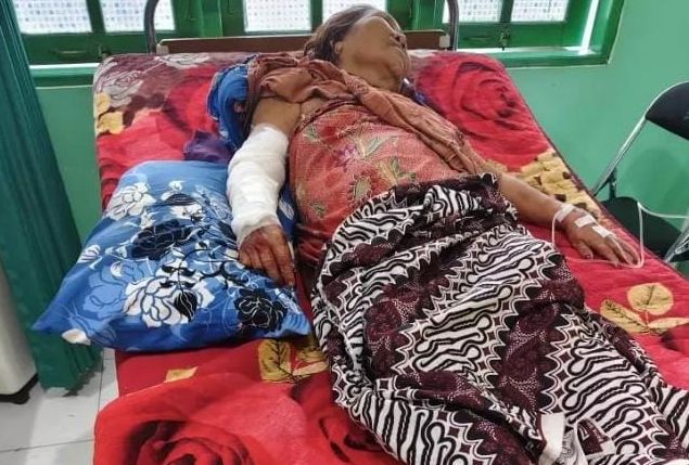 Nenek 63 Tahun di Kotim Diserang Buaya Saat Mandi di Sungai, Selamat Meski Luka Robek
