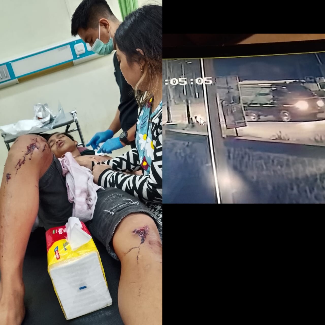 Korban tabrak lari, supir pik up langsung kabur dalam masa pencarian satlantas polres kotim 